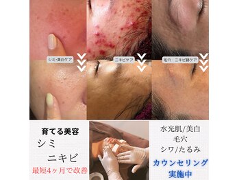 ネイルアンドビューティー モアリボン(Nail&Beauty More Libbon)