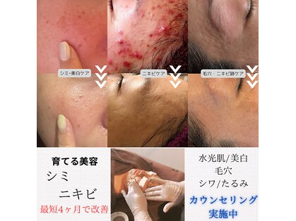 ネイルアンドビューティー モアリボン(Nail&Beauty More Libbon)の写真