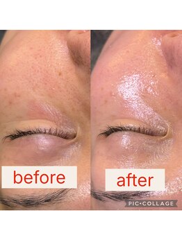 シャルム(CHARME)/マーメイドセルトリートメント