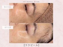 ビベル 八木店(Bebelle)/３回