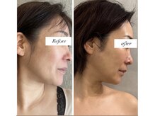 アリィ(Alii)/50代まだまだ輝くお手伝いします