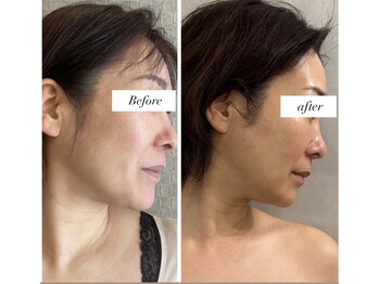 アリィ(Alii)/50代まだまだ輝くお手伝いします