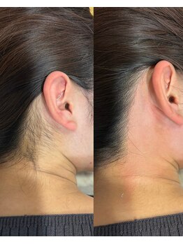ミオワックス(MIOWAX)の写真/リラックス空間で肌負担を考えたフェイシャルワックスを体験!【南福島駅徒歩1分/無料駐車場店舗前にあり】