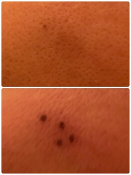 ホワイトローズ(White Rose)/最新にして最後のシミケア!