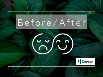 セレウス(Cereus)/●Before／After