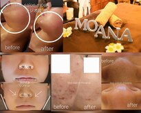 リノサロン モアナ(lino salon moana)