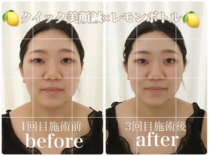 アキュモンド 渋谷院(acumond)の写真