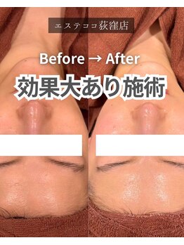 エステ ココ 荻窪店(Esthe CoCo)/美肌/肌管理/毛穴