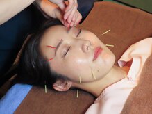 リカバリー整体院 太宰府院の雰囲気（美容鍼とボディ鍼灸でお顔も身体も徹底ケア◎内側から巡り改善!）