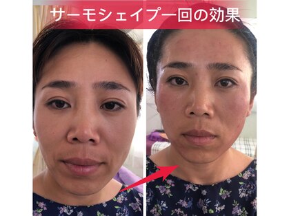 東洋経絡リラクゼーションの写真