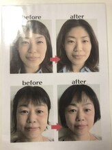美容整体サロン オオカンシャ(okansha)/小顔Before→after
