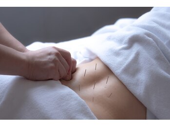 アキュパンクト ラボ 片山治療院(Acupunct Lab 片山治療院)/腰