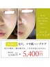 人気NO.1《ツヤ肌ハーブピーリング》剥離なし/毛穴ケア/乾燥ケア/トーンUP
