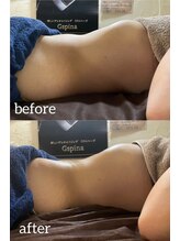 サロンドカメリア(salon de Camellia)/ちあき先生の腸揉みの効果が絶大