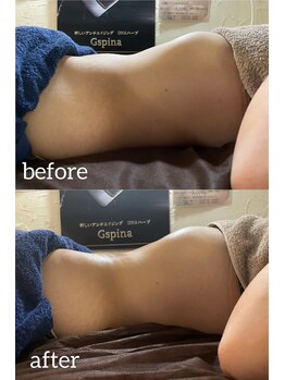 サロンドカメリア(salon de Camellia)/ちあき先生の腸揉みの効果が絶大