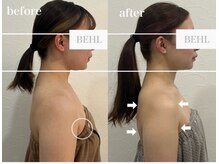 ベール(BEHL)/コルギのBefore After