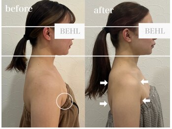 ベール(BEHL)/コルギのBefore After