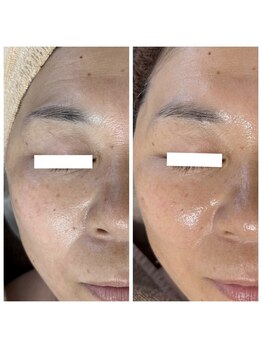 ジャスミン(Jasmine)/