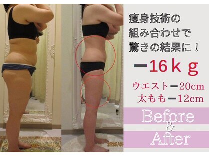 クリニカルエステ イーズ 京橋店の写真