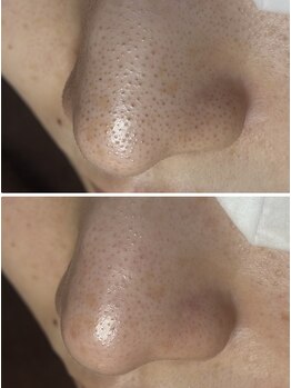 フラリス(fraris)/