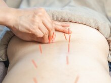 ひじ鍼灸整骨院