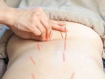 ひじ鍼灸整骨院の写真/ずっと放置している腰の違和感、そのままにしていませんか？重いと感じるその前に熟練の技でリフレッシュ☆