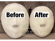 美極 トータルビューティー(美極 TOTAL BEAUTY)/恵比寿/小顔コルギ/エステ/