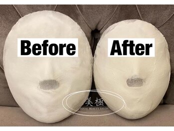 美極 トータルビューティー(美極 TOTAL BEAUTY)/恵比寿/小顔コルギ/エステ/