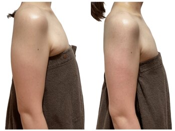 痩せラボ/ノースリーブ着れます【痩身】