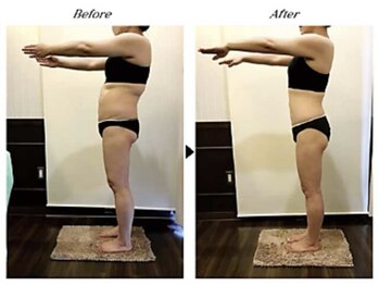 ビューティークリニックコダマ 延岡店/【2ヶ月コース】M.N様(38歳)