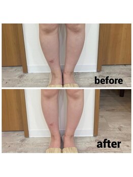 サロンシファ(salon sifa)/インディバ60分