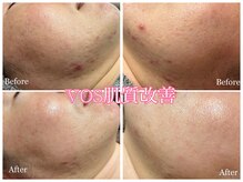 ティアーナ(Tiaana)