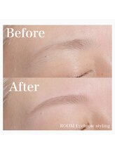 ルーム(ROOM)/ビフォーアフター◎