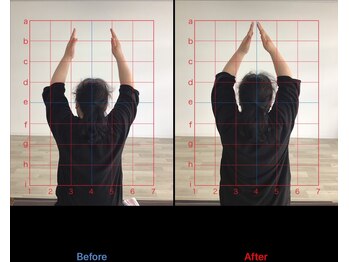 ストレチックス 近江八幡店/BeforeAfter