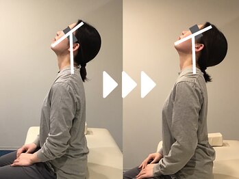 ミライズ整体院 三宮本院/事例【20代女性・首こり】