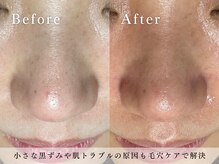 ハリウッド ラボ 本店(HOLLYWOOD LAB)/