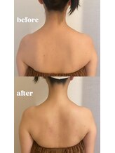 リブ シャルム(Lib Charm)/コルギマッサージ1回施術