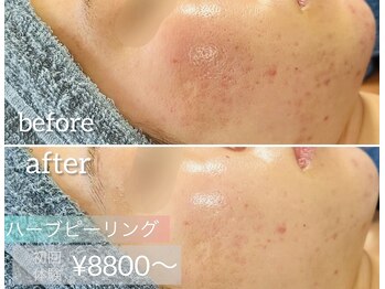 ベルハーブ(Belle herb)