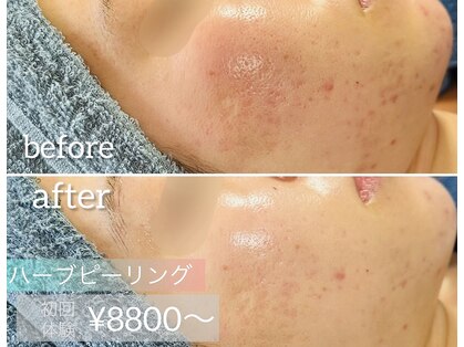 ベルハーブ(Belle herb)の写真