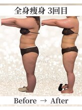 ドレス(dress)/全身痩身Before/After