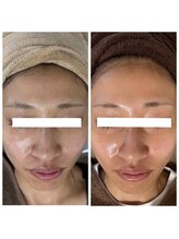 ジャスミン(Jasmine)/