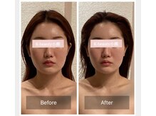 ケービューティー 小顔(K-beauty)/小顔コルギ60分