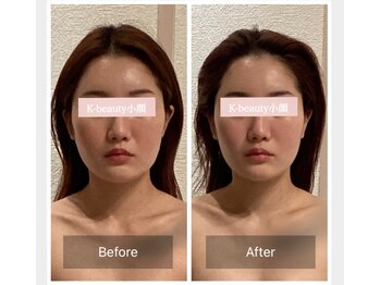 ケービューティー 小顔(K-beauty)/小顔コルギ60分