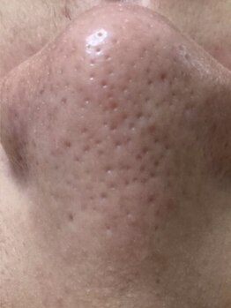 お肌をきれいにしたい