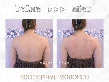 エステプリヴェモロッコ(ESTHE PRIVE MOROCCO)