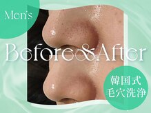 クリアラボ 池袋2nd(Clear Lab)の雰囲気（メンズ/毛穴/毛穴洗浄/毛穴ケア/黒ずみ/ピーリング/池袋/池袋駅）