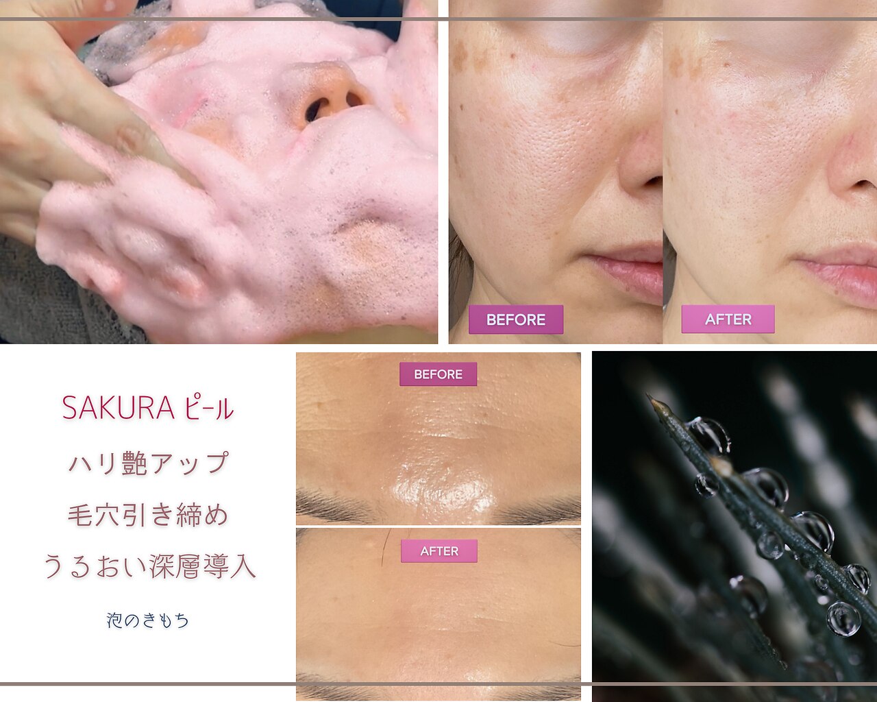 新潟駅で毛穴洗浄・毛穴吸引が人気のエステサロン｜ホットペッパー