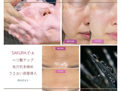 泡のきもちの写真