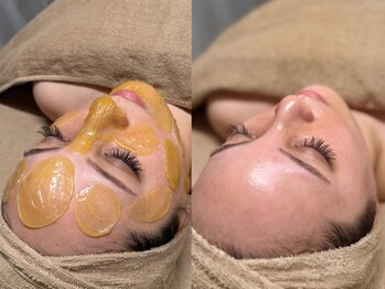 ルミエ(Lumie)の写真/潤艶フェイスWAXで産毛×角質×毛穴汚れを一掃!水分導入と合わせて憧れのぷるぷる韓国艶肌へ♪