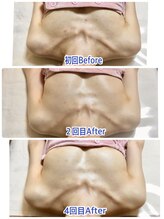 トータルボディセラピーハート(Heart)/バストアップ +肌質改善も同時に